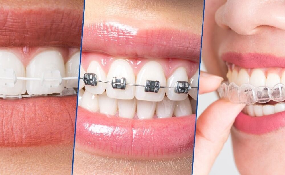 Straighten Your Smile with Expert Orthodontics in Kolkata