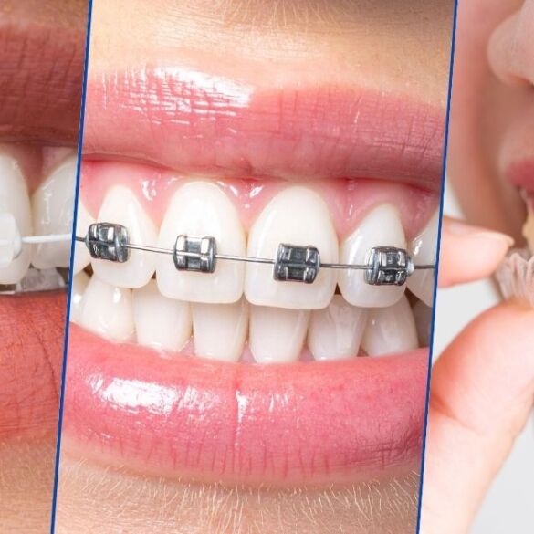 Straighten Your Smile with Expert Orthodontics in Kolkata