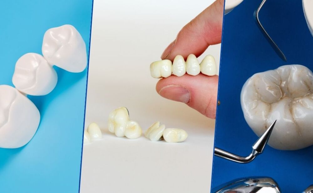 Expert Prosthodontic Care in Kolkata