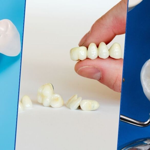 Expert Prosthodontic Care in Kolkata