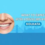 What to Expect After a Dental Implant in Kolkata