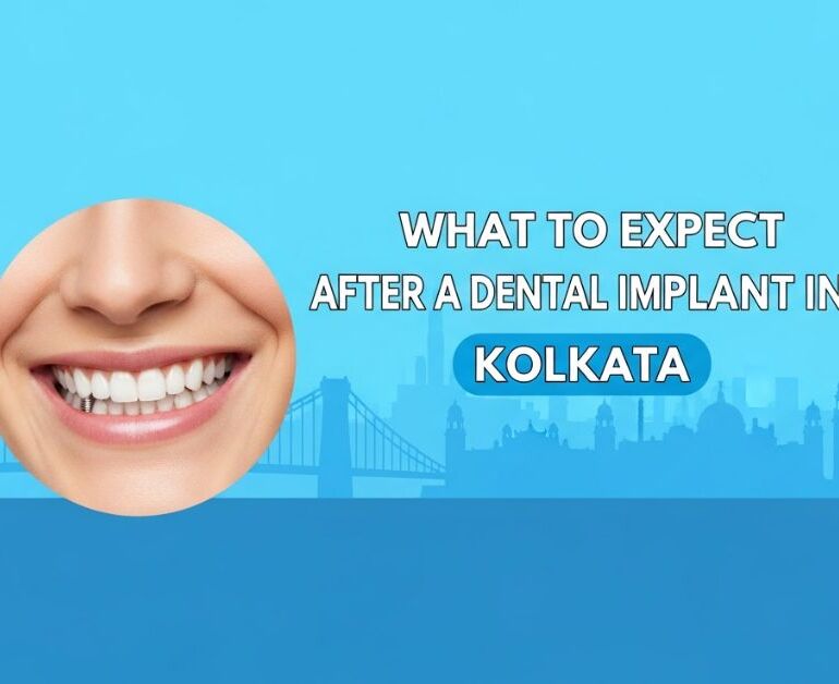 What to Expect After a Dental Implant in Kolkata