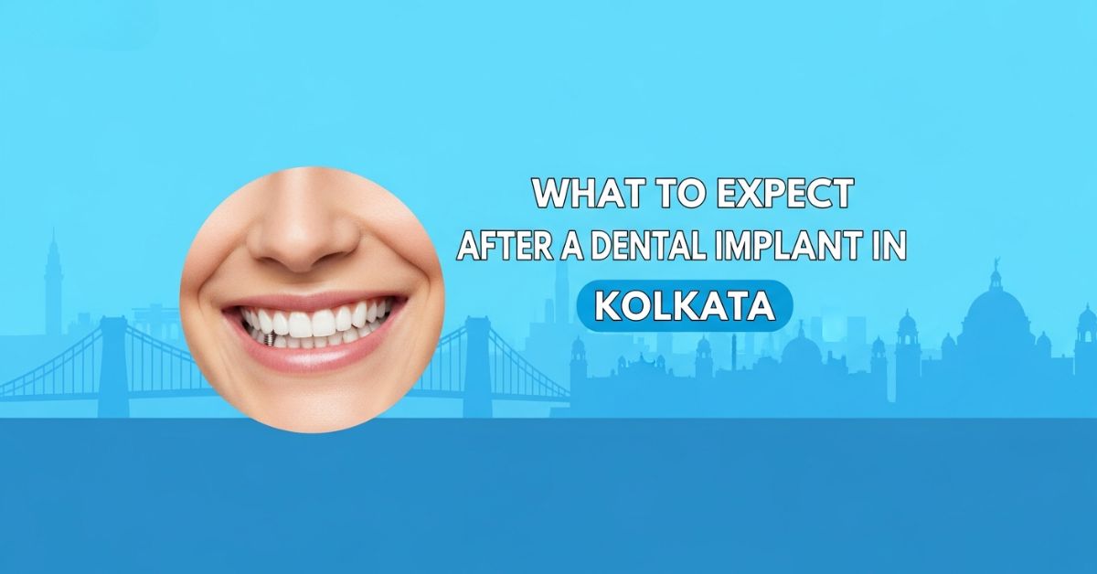 What to Expect After a Dental Implant in Kolkata