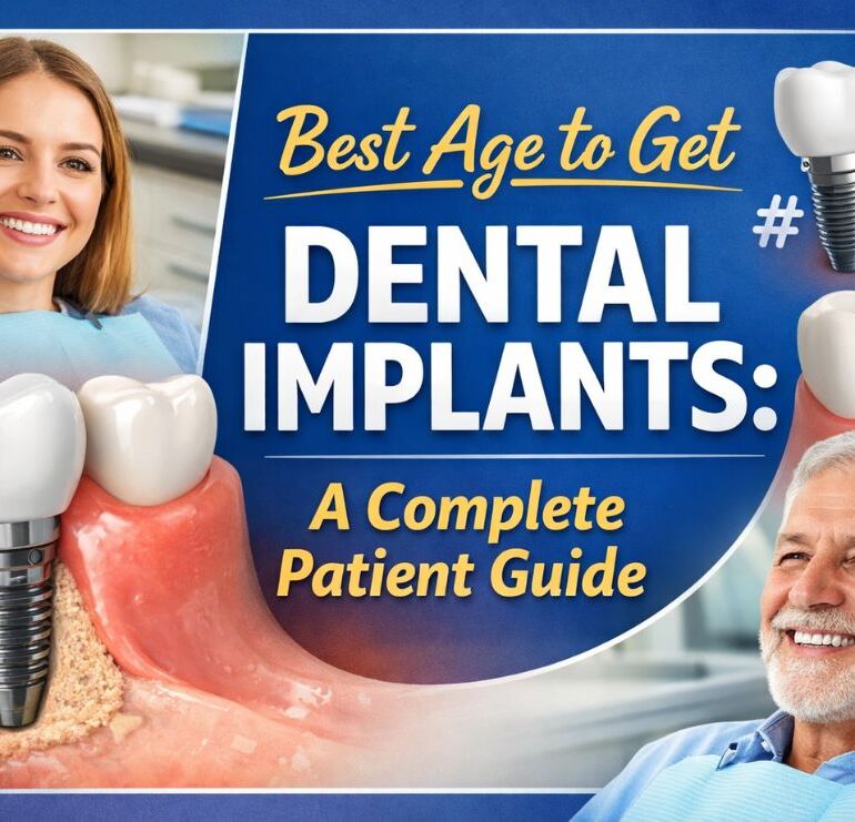 Best Age to Get Dental Implants: A Complete Patient Guide 4 Best Age to Get Dental Implants: A Complete Patient Guide