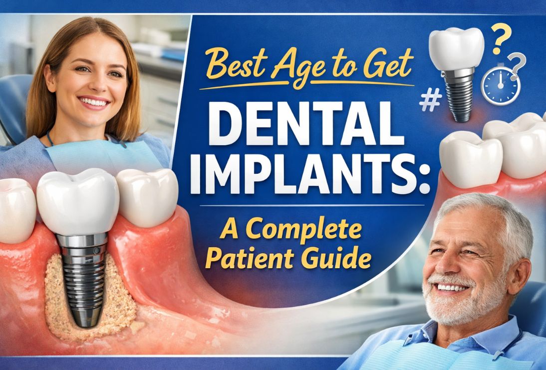 Best Age to Get Dental Implants: A Complete Patient Guide 17 Best Age to Get Dental Implants: A Complete Patient Guide