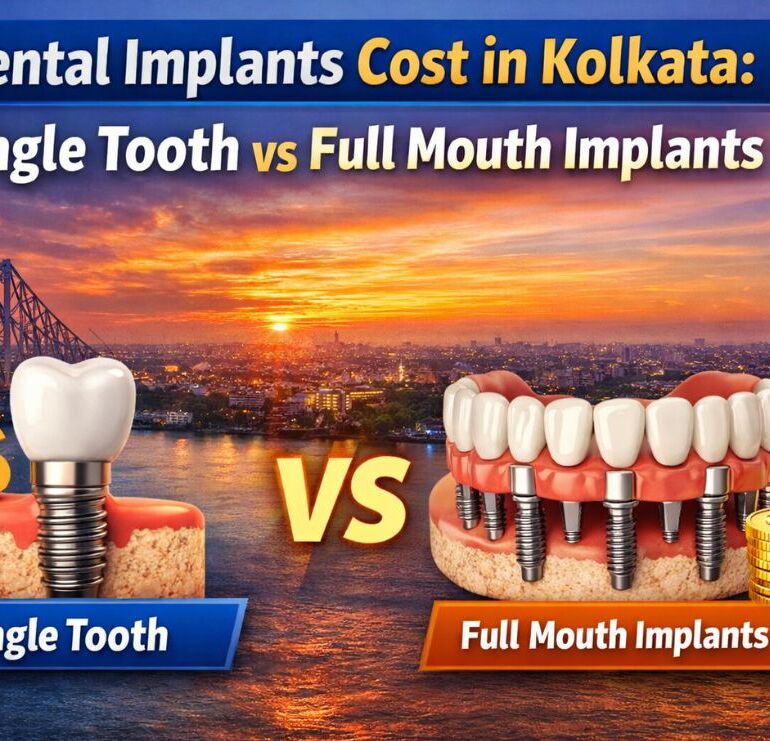 Dental Implants Cost in Kolkata: Single Tooth vs Full Mouth Implants 5 Dental Implants Cost in Kolkata | Single Tooth vs Full Mouth Implants
