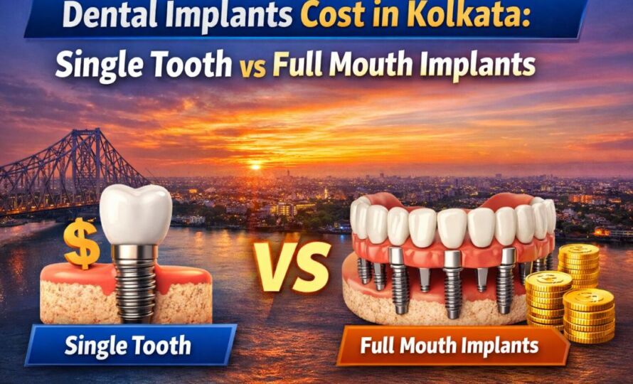 Dental Implants Cost in Kolkata: Single Tooth vs Full Mouth Implants 10 Dental Implants Cost in Kolkata | Single Tooth vs Full Mouth Implants