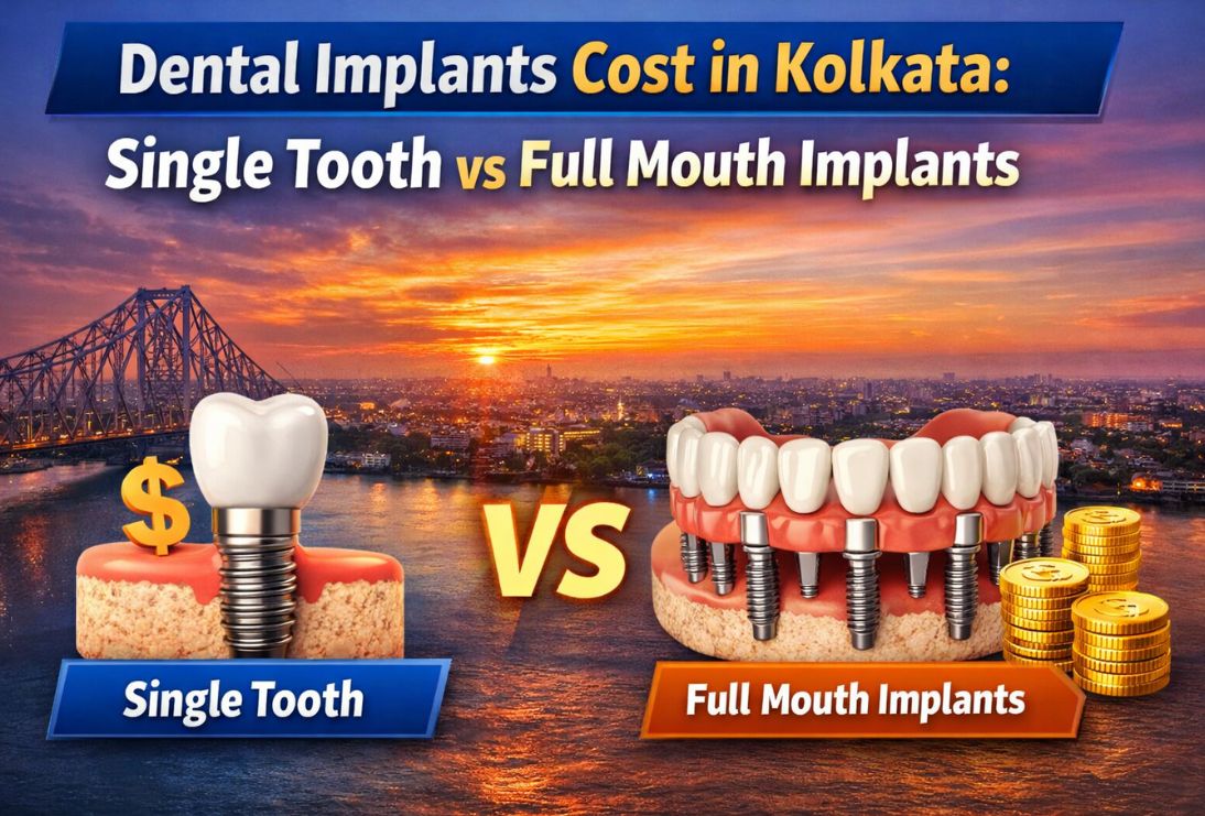 Dental Implants Cost in Kolkata | Single Tooth vs Full Mouth Implants