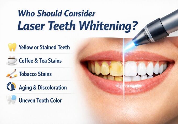 Laser teeth whitening treatment showing before and after results for yellow or stained teeth caused by coffee, tobacco, aging, and uneven tooth color.