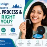 Invisalign in Kolkata: Cost, Process & Is It Right for You?