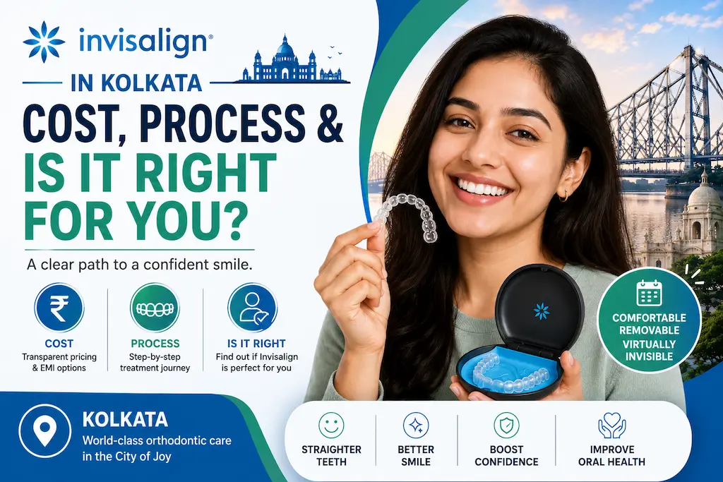 Invisalign in Kolkata: Cost, Process & Is It Right for You? 17 Invisalign in Kolkata: Cost, Process & Is It Right for You?