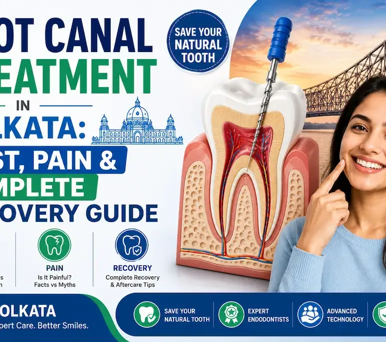 Root Canal Treatment in Kolkata: Cost, Pain & Complete Recovery Guide 5 Root Canal Treatment in Kolkata: Cost, Pain & Complete Recovery Guide